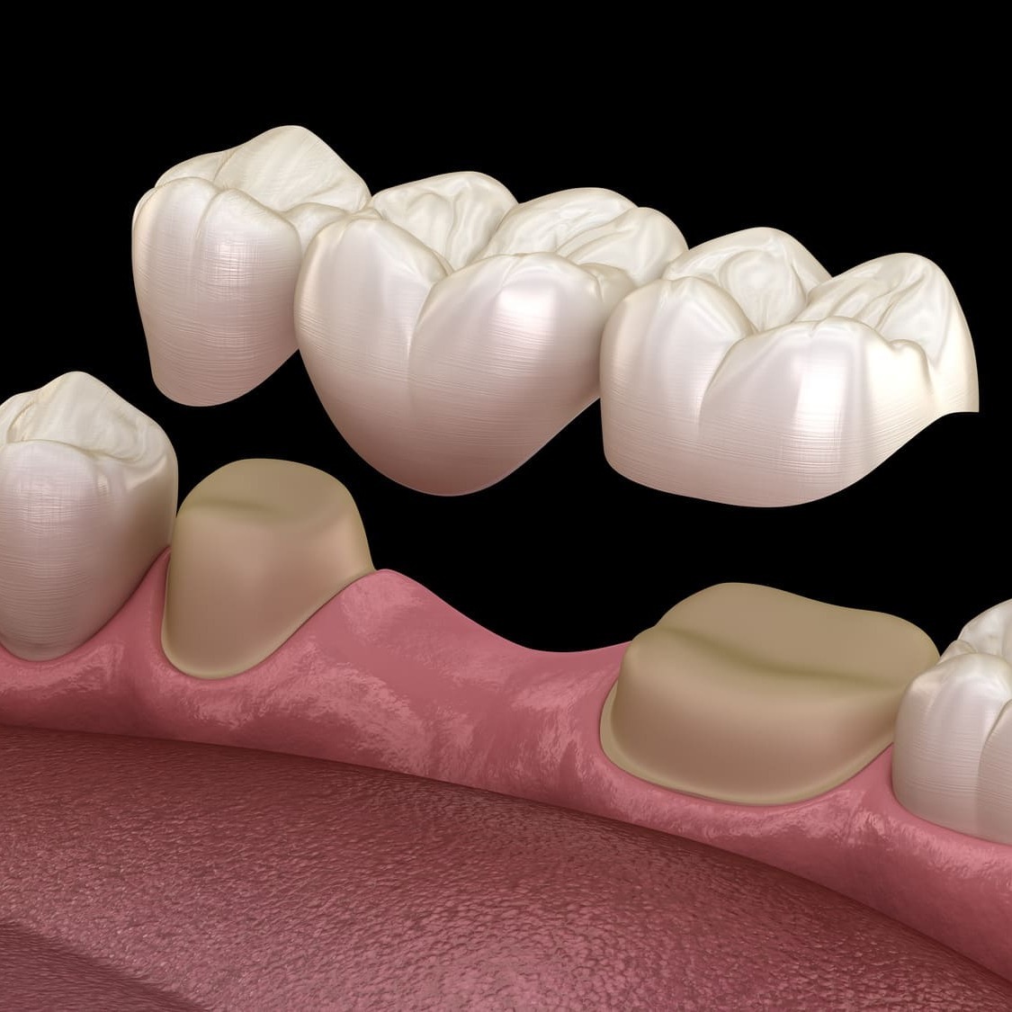 Fine Art Dental of Flushing dental care image