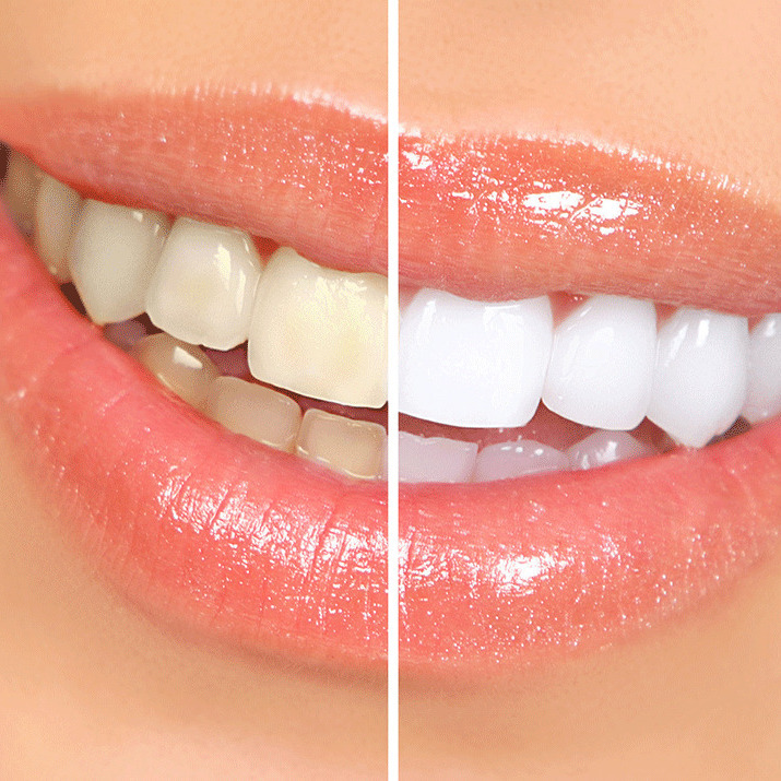Fine Art Dental of Flushing dental care image
