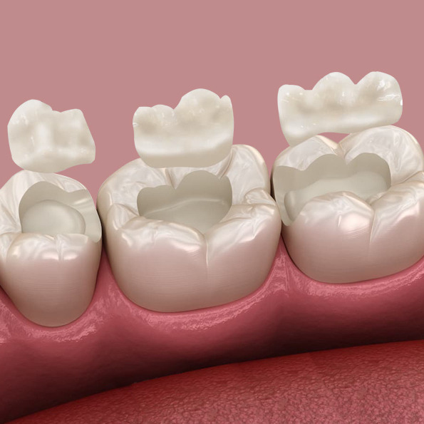 Fine Art Dental of Flushing dental care image