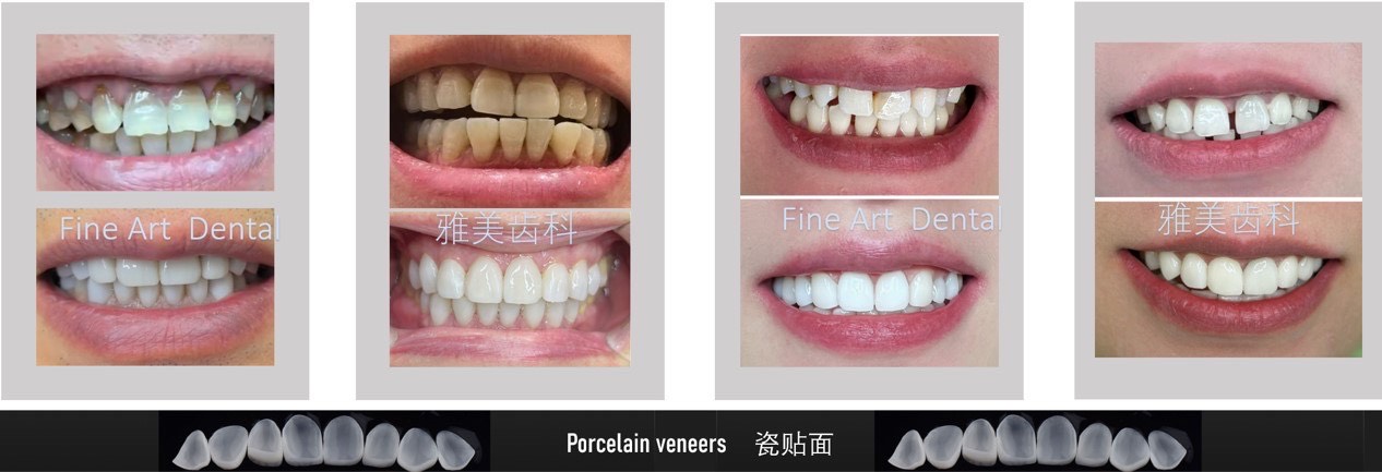 Dental Case Study 1