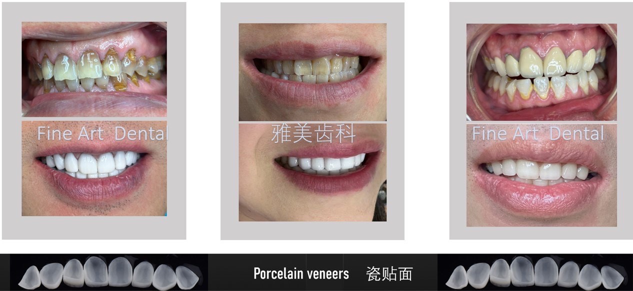 Dental Case Study 3