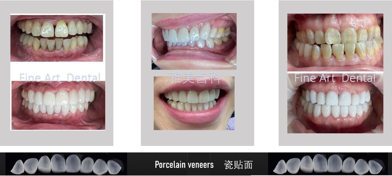 Dental Case Study 4