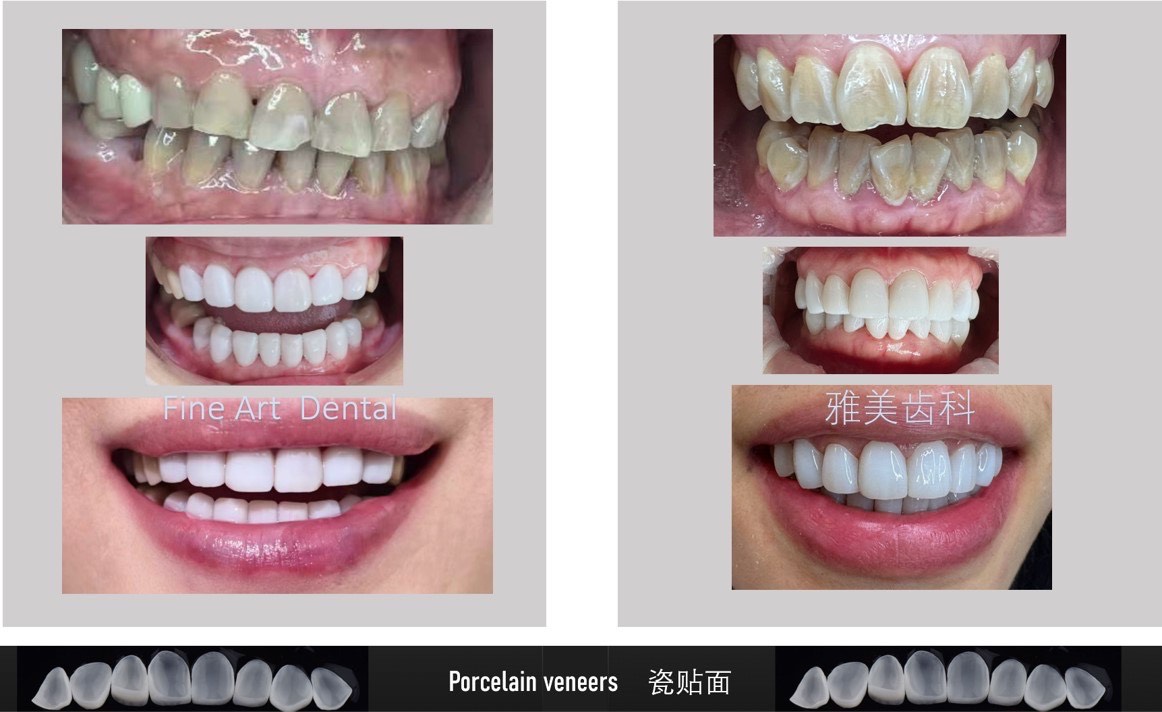 Dental Case Study 5