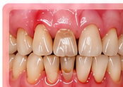Crowding and hygiene risk
