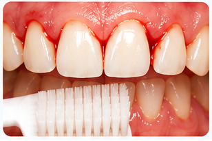 Gum health and oral hygiene
